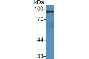 Detection of PPARgC1a in Rat Serum using Polyclonal Antibody to Peroxisome Proliferator Activated Receptor Gamma Coactivator 1 Alpha (PPARgC1a) (PPARGC1A Antikörper  (AA 588-773))
