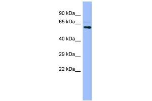 WB Suggested Anti-CYP4A22 Antibody Titration:  0. (CYP4A22 Antikörper  (N-Term))