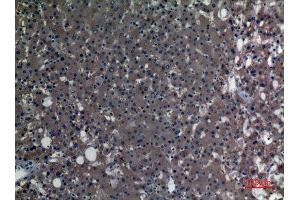 Immunohistochemistry (IHC) analysis of paraffin-embedded Human Liver, antibody was diluted at 1:100. (ALDH1A1 Antikörper  (N-Term))