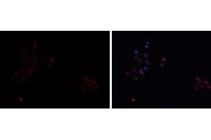 ABIN6276742 staining HEPG2 cells by IF/ICC. (SCARB1 Antikörper  (Internal Region))