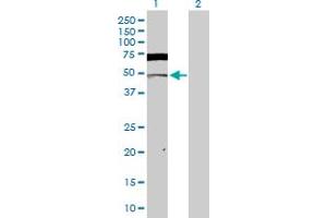 Western Blot analysis of CSNK2A1 expression in transfected 293T cell line by CSNK2A1 MaxPab polyclonal antibody. (CSNK2A1/CK II alpha Antikörper  (AA 1-391))
