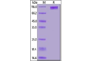 SDS-PAGE (SDS) image for Guanylate Cyclase 2C (Heat Stable Enterotoxin Receptor) (GUCY2C) (AA 24-430) (Active) protein (Fc Tag) (ABIN7013473)