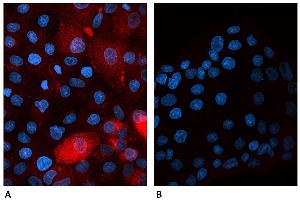 Confocal microscopy of human β2-microglobulin-transfected canine cells labeled A) with B2M-01 antibody Alexa Fluor® 647 conjugate  and B) with Alexa Fluor® 647 conjugated Mouse IgG2a Isotype Control (A6-458-C100). (beta-2 Microglobulin Antikörper  (FITC))