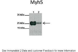 Lanes:   1: Mouse heart lysate, 2: Mouse skeletal muscle lysate  Primary Antibody Dilution:   1:1000  Secondary Antibody:   Anti-rabbit HRP  Secondary Antibody Dilution:   1:10000  Gene Name:   MYF5  Submitted by:   Anonymous (MYF5 Antikörper  (N-Term))