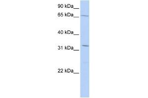 WB Suggested Anti-TRIM22 Antibody Titration:  0. (TRIM22 Antikörper  (Middle Region))