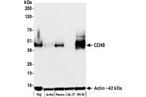 Western Blotting (WB) image for anti-CD48 (CD48) (AA 29-220) antibody (ABIN7795688)