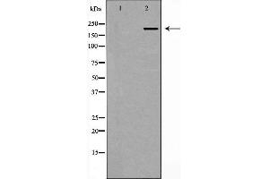 Western blot analysis of Hela whole cell lysates, using PCM1 Antibody. (PCM1 Antikörper  (N-Term))