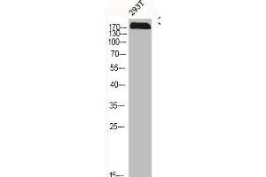 Western Blotting (WB) image for anti-Cystic Fibrosis Transmembrane Conductance Regulator (ATP-Binding Cassette Sub-Family C, Member 7) (CFTR) antibody (ABIN7180806)