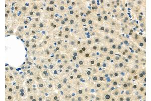 ABIN6263252 and ABIN6279536 at 1/100 staining Rat liver tissue by IHC-P. (m1ip1 Antikörper  (Internal Region))