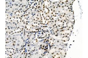 Phospho-SRPK2 (Thr492) Antibody at 1/100 staining Mouse kidney tissue by IHC-P. (SRPK2 Antikörper  (pThr492))