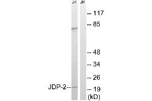 Western blot analysis of extracts from Jurkat cells, using JDP-2 (Ab-148) antibody. (JDP2 Antikörper  (Thr148))