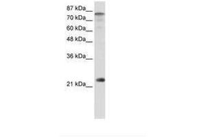 Image no. 1 for anti-Nuclear Transcription Factor Y, beta (NFYB) (N-Term) antibody (ABIN6736220) (NFYB Antikörper  (N-Term))