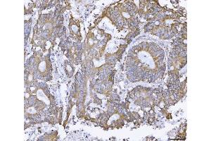 IHC analysis of ATX2/ATXN2 using anti-ATX2/ATXN2 antibody (ABIN3043507). (Ataxin 2 Antikörper  (C-Term))