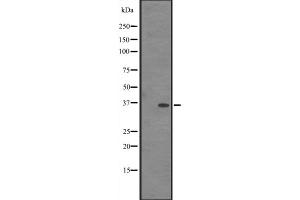 Western blot analysis of IN35 expression in HEK293 cells ,The lane on the left is treated with the antigen-specific peptide. (IFI35 Antikörper  (C-Term))