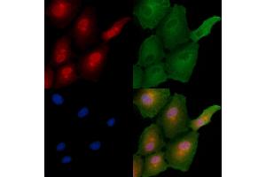 ABIN6257317 and ABIN6275836 staining  cells by IF/ICC. (MAGEC2 Antikörper  (Internal Region))