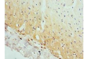 Immunohistochemistry (IHC) image for anti-Adaptor-Related Protein Complex 2, alpha 2 Subunit (AP2A2) (AA 590-939) antibody (ABIN7144362)