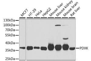 Western blot analysis of extracts of various cell lines, using PDXK antibody. (PDXK Antikörper  (AA 1-312))