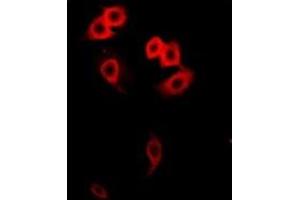 Immunofluorescent analysis of GalNAc-T2 staining in Hela cells. (GalNAc-T2 Antikörper)
