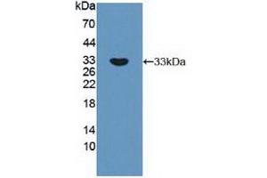 Western Blotting (WB) image for anti-Ribosomal Protein S6 Kinase, 70kDa, Polypeptide 1 (RPS6KB1) (AA 91-352) antibody (ABIN7430135)