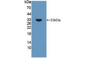 Detection of Recombinant RPS6Kb1, Human using Polyclonal Antibody to Ribosomal Protein S6 Kinase Beta 1 (RPS6Kb1) (RPS6KB1 Antikörper  (AA 91-352))