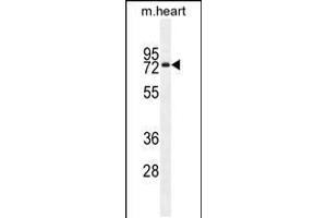 Western blot analysis in mouse heart tissue lysates (35ug/lane). (Otopetrin 1 Antikörper  (AA 360-388))