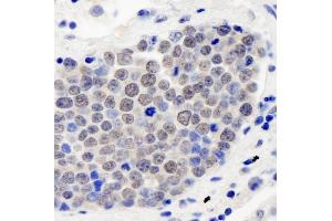 anti-Casein kappa (CSN3) (AA 325-375) antibody