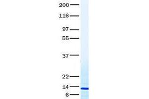 Validation with Western Blot (XCL1 Protein)