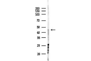 anti-BTB (POZ) Domain Containing 6 (BTBD6) (Internal Region) antibody
