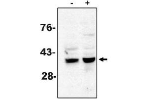 Western Blotting (WB) image for anti-Caspase 7, Apoptosis-Related Cysteine Peptidase (CASP7) antibody (ABIN264418) (Caspase 7 Antikörper)