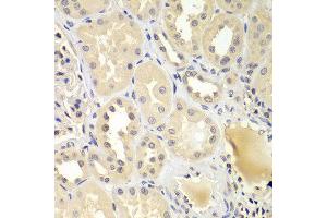 Immunohistochemistry of paraffin-embedded human kidney using UBE2Z antibody at dilution of 1:100 (40x lens). (UBE2Z Antikörper)