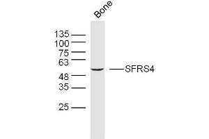Mouse bone lysates probed with SFRS4 Polyclonal Antibody, Unconjugated  at 1:300 overnight at 4˚C. (SRSF4 Antikörper  (AA 1-100))
