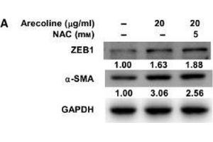 Western Blotting (WB) image for anti-Glyceraldehyde-3-Phosphate Dehydrogenase (GAPDH) antibody (ABIN2857072)