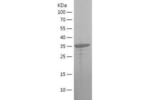 HSD17B10 Protein (AA 43-146) (His-IF2DI Tag)