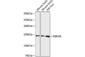 Western blot analysis of extracts of various cell lines using RBM26 Polyclonal Antibody at dilution of 1:3000. (RBM26 Antikörper)