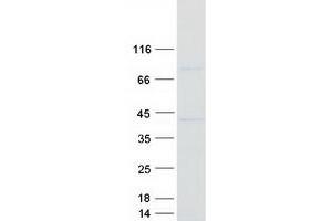Western Blotting (WB) image for Capping Protein (Actin Filament) Muscle Z-Line, alpha 2 (CAPZA2) protein (Myc-DYKDDDDK Tag) (ABIN2713117)