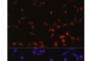 Immunofluorescence analysis of NIH/3T3 cells using ZEB2 Polyclonal Antibody at dilution of 1:100. (ZEB2 Antikörper)