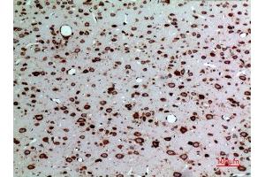 Immunohistochemistry (IHC) analysis of paraffin-embedded Rat Brain, antibody was diluted at 1:100. (Midkine Antikörper  (Internal Region))