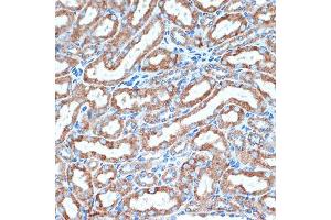 Immunohistochemistry (IHC) image for anti-Tumor Necrosis Factor Receptor Superfamily, Member 10d, Decoy with Truncated Death Domain (TNFRSF10D) antibody (ABIN7271063)