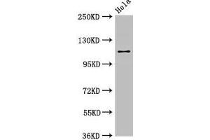 Western Blot Positive WB detected in: Hela whole cell lysate All lanes: SEC23IP antibody at 2. (SEC23IP Antikörper  (AA 779-989))
