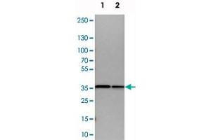 Western blot analysis of cell lysates with ARPC1B polyclonal antibody . (ARPC1B Antikörper)