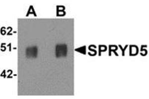 Western blot analysis of SPRYD5 in rat brain tissue lysate with SPRYD5 antibody at (A) 0. (TRIM51 Antikörper  (C-Term))