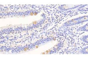 Detection of SERPINA10 in Human Small intestine Tissue using Polyclonal Antibody to Serpin A10 (SERPINA10) (SERPINA10 Antikörper  (AA 24-444))