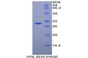 Protease protein