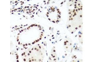 Immunohistochemistry of paraffin-embedded Human stomach using Histone H2AX Polyclonal Antibody at dilution of 1:100 (40x lens). (H2AFX Antikörper)