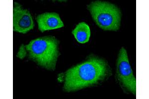 A549 cells were stained with HDAC4 (6B10) Monoclonal Antibody  at [1:200] incubated overnight at 4C, followed by secondary antibody incubation, DAPI staining of the nuclei and detection. (HDAC4 Antikörper)