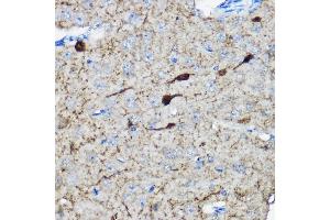 Immunohistochemistry of paraffin-embedded mouse brain using Calretinin Rabbit pAb (ABIN6129247, ABIN6137849, ABIN6137850 and ABIN6225108) at dilution of 1:100 (40x lens).