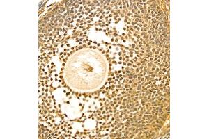 Immunohistochemistry of paraffin embedded rat ovary using PTPN2 (ABIN7075295) at dilution of 1:900 (400x lens)