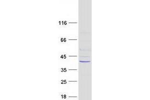 Western Blotting (WB) image for THO Complex 6 Homolog (THOC6) (Transcript Variant 1) protein (Myc-DYKDDDDK Tag) (ABIN2735524)