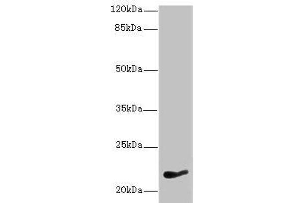 NKIRAS1 Antikörper  (AA 1-192)