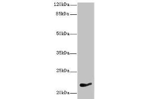 Western blot All lanes: NKIRAS1 antibody at 7 μg/mL + HepG2 whole cell lysate Secondary Goat polyclonal to rabbit IgG at 1/10000 dilution Predicted band size: 22 kDa Observed band size: 22 kDa (NKIRAS1 Antikörper  (AA 1-192))